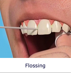 Flossing